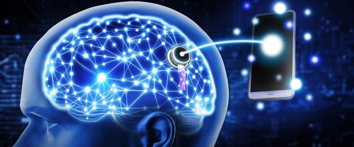 Brain-computer-interface