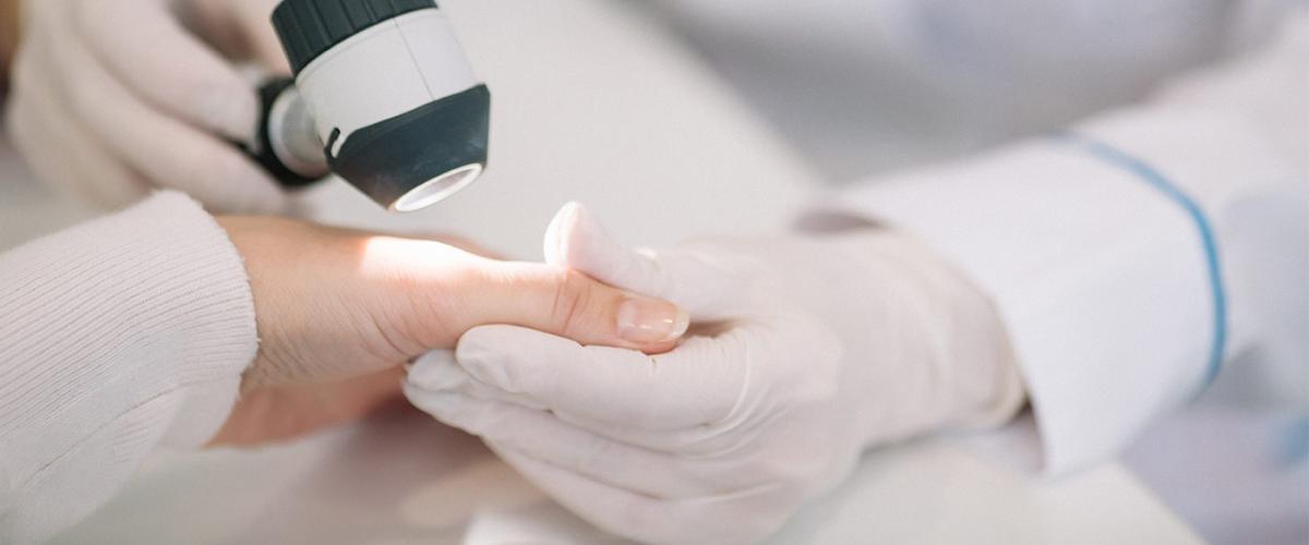 Skin-Testing