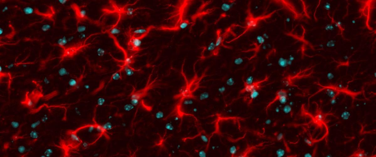 astrocytes