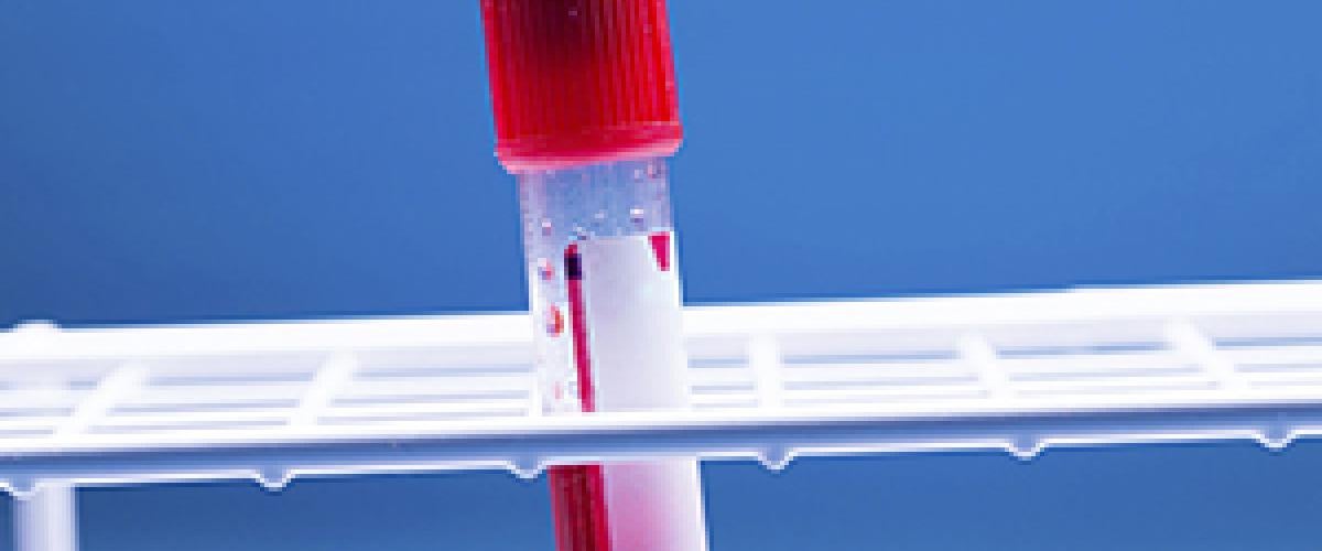 blood-testtube