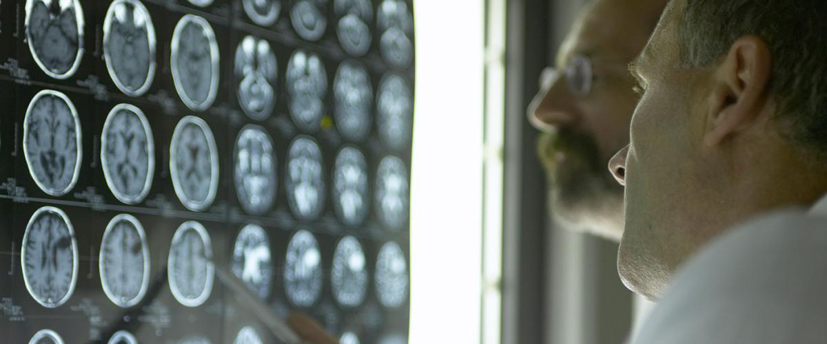 brain-scans-feat