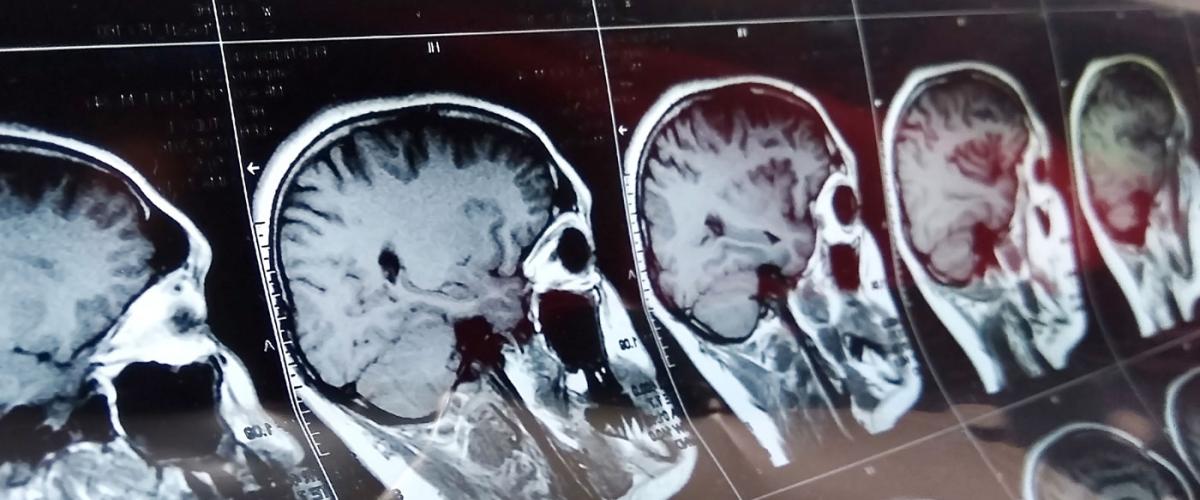 brainwp