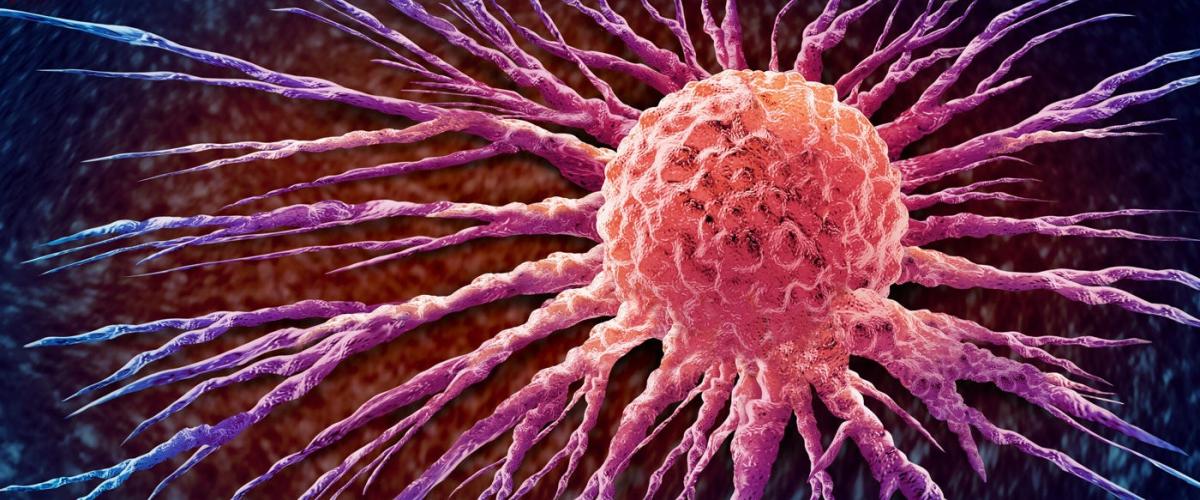 breast-cancer-feat