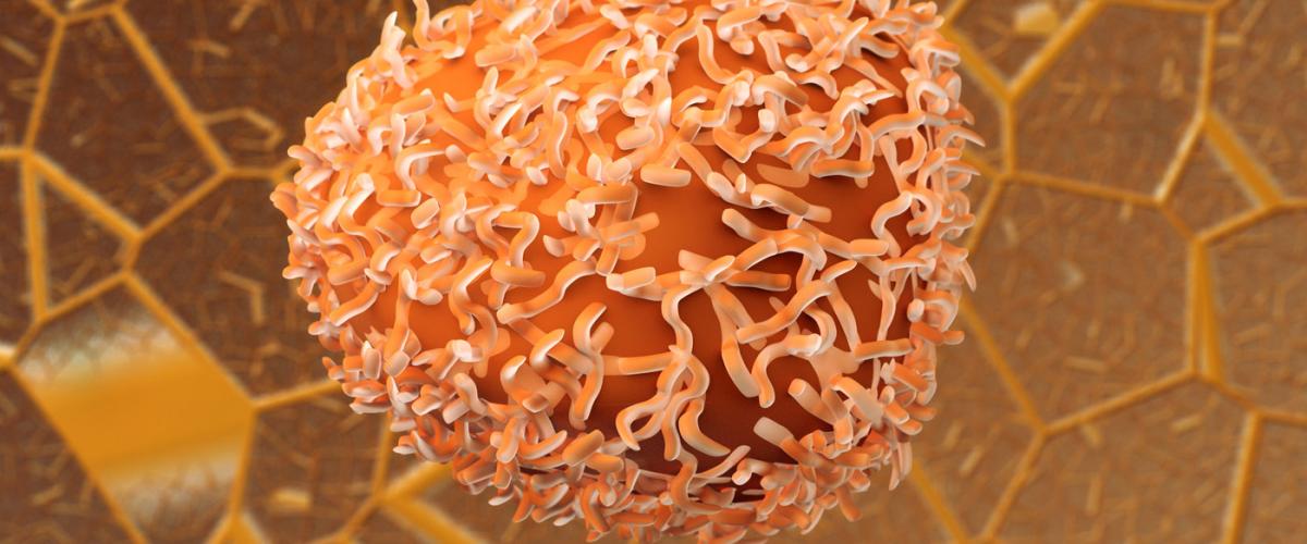 colon-cancer-cells