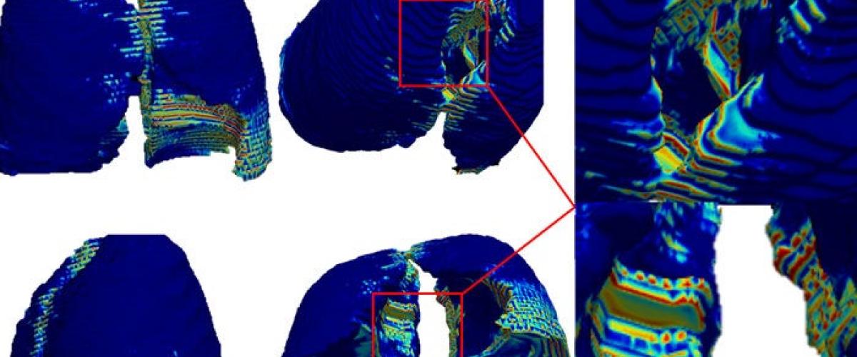 covid-scan