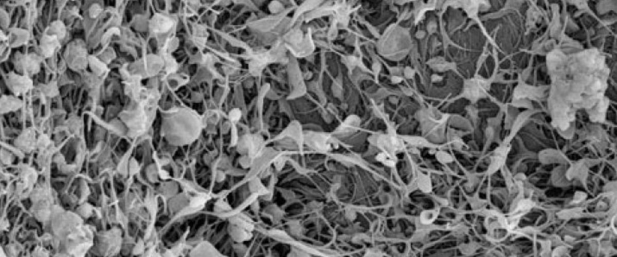 clot-stabilizing-nanotechnology.jpg