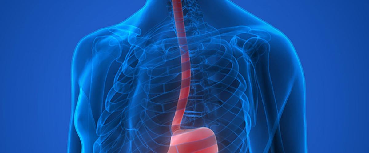169esophagus.jpg