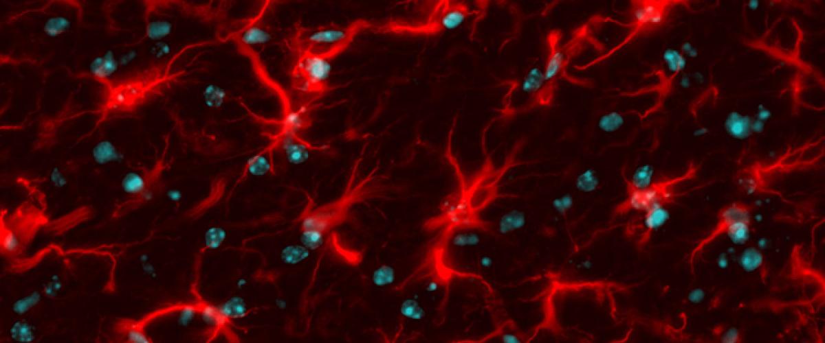 astrocytes.jpeg