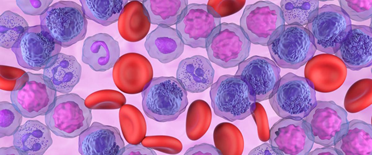 leukemia%20blood%20cells%20stock.jpg