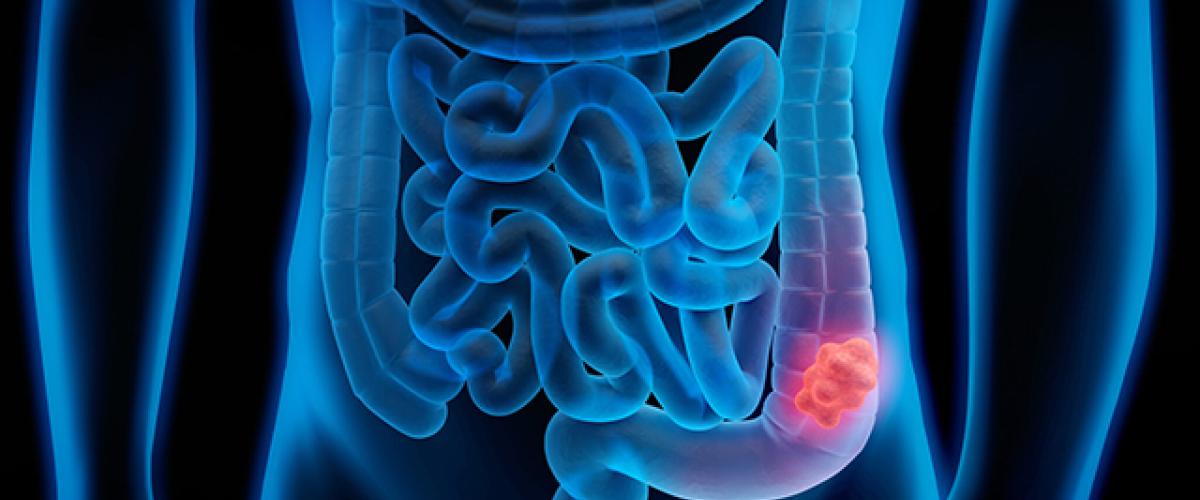 stockgettycolon.jpg