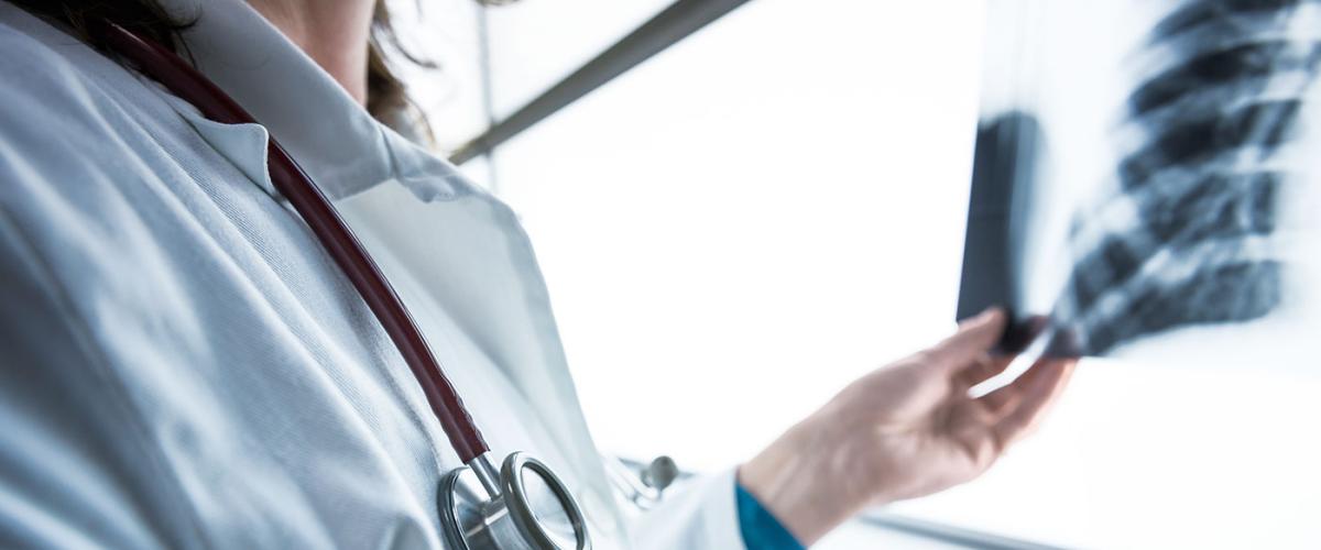 doctor-chest-xray