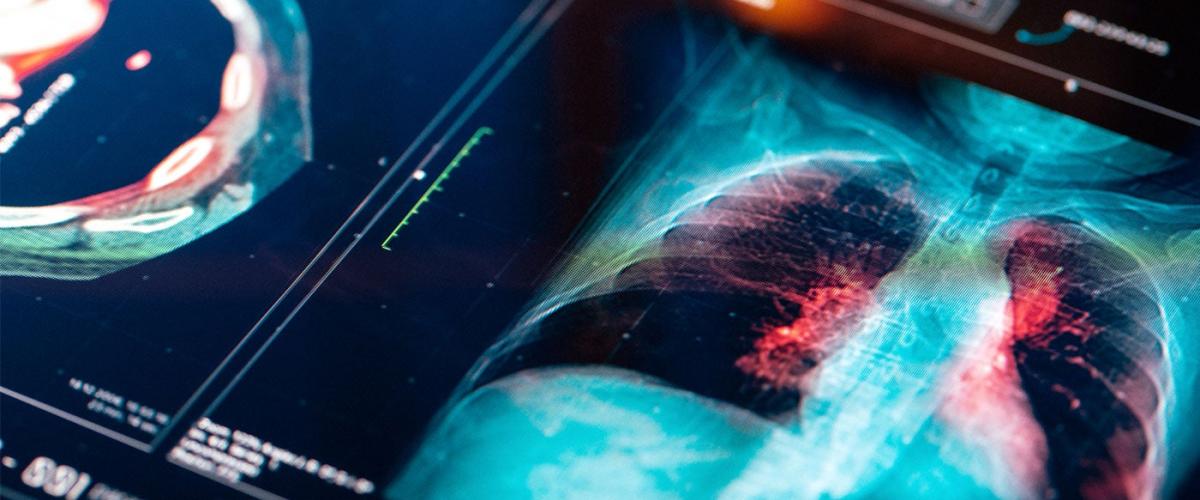 lung-imaging