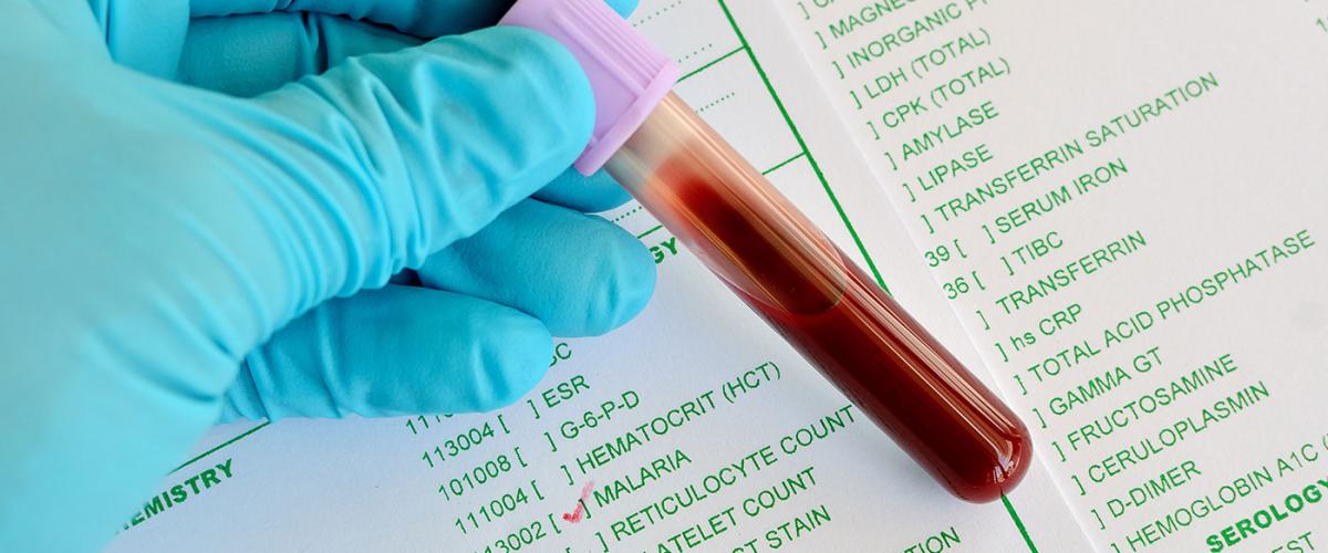 malaria-testing-feat