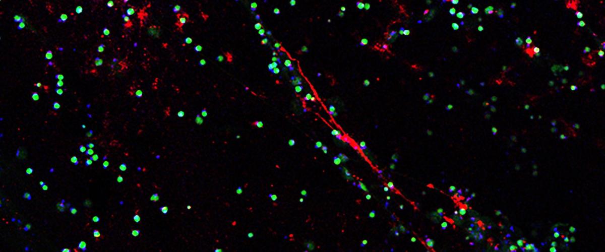nanoparticles-feat