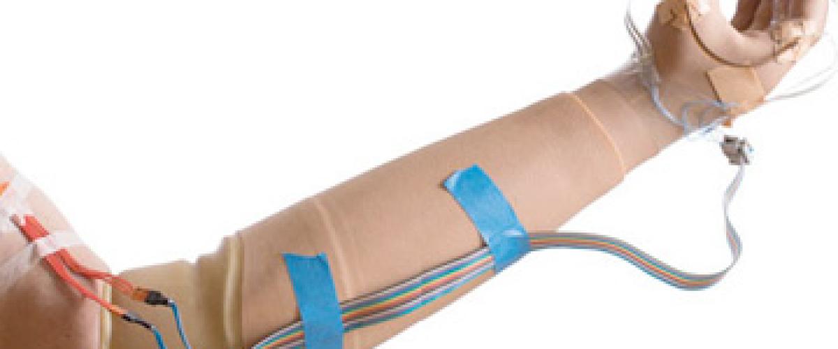 prosthetic-arm