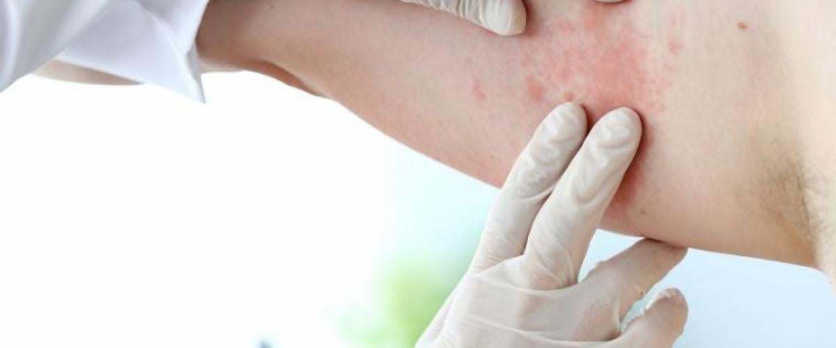 skin-disease