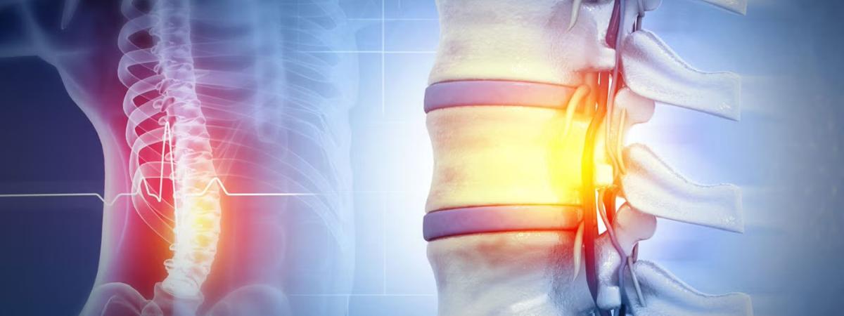 Spinal cord
