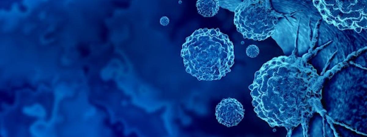 Graphic of cancer cells