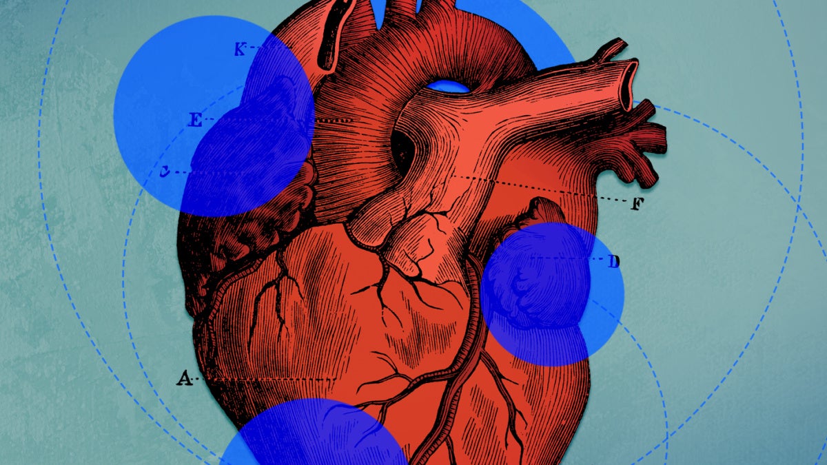 Illustrated heart in red on a teal background with overlapping blue circles. Medical and artistic elements blend to create a dynamic, thought-provoking image.