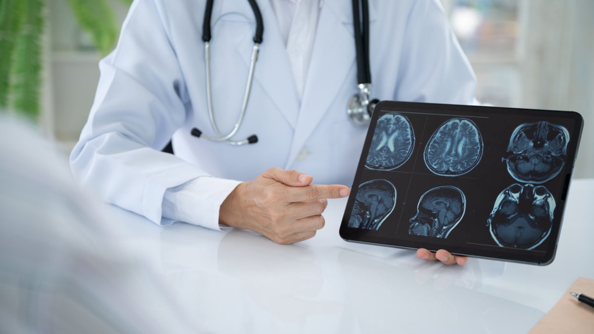 Physician going over brain scan