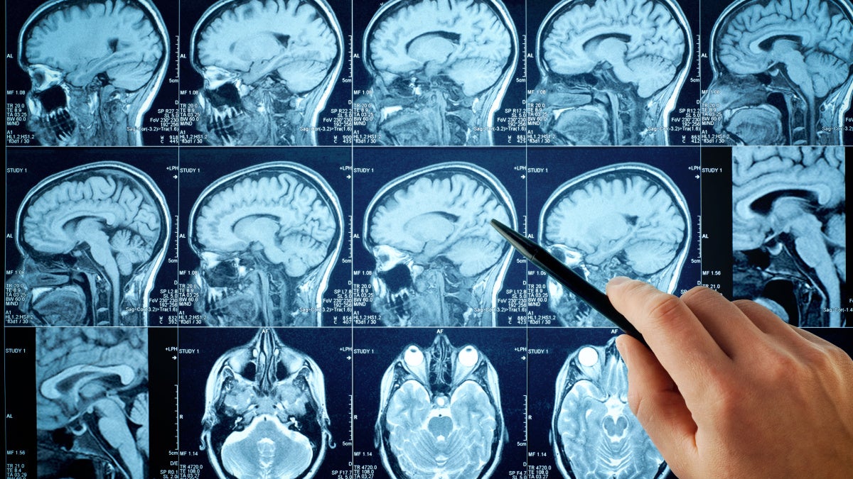 Photo of brain scans for medical research.
