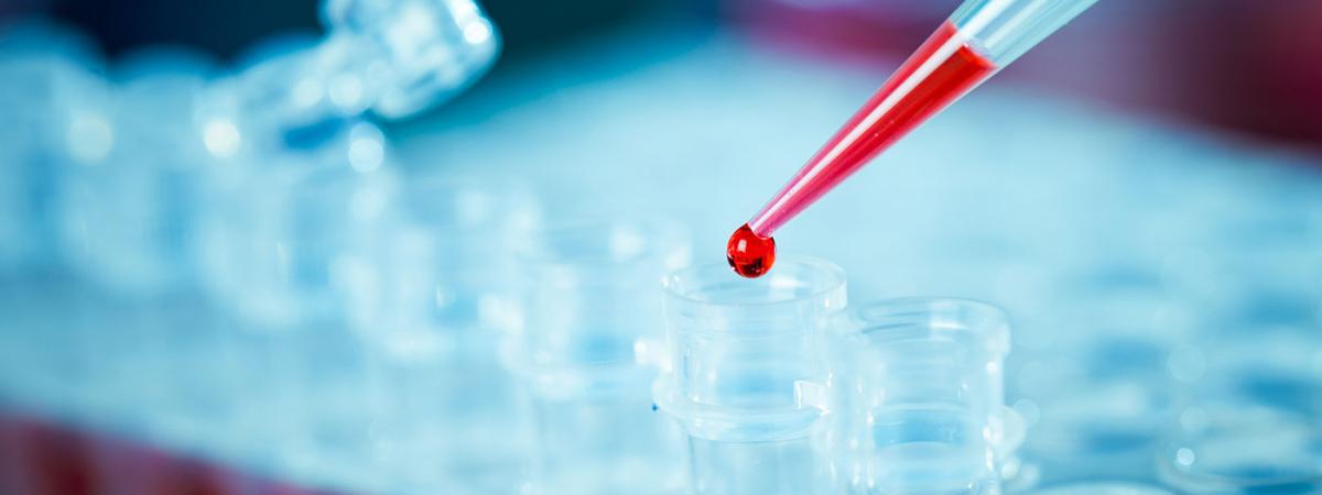 BloodBiomarkers