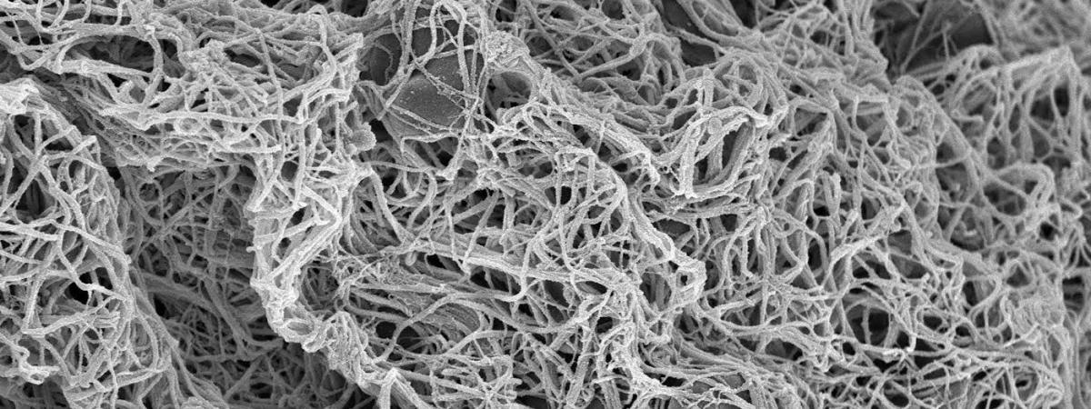 Fibrin_highres