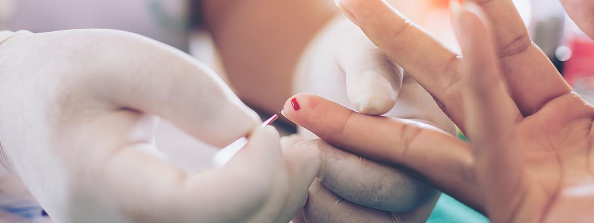 blood-test
