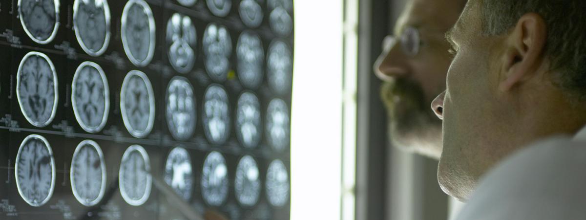 brain-scans-feat
