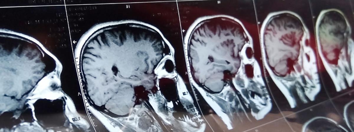 brainwp