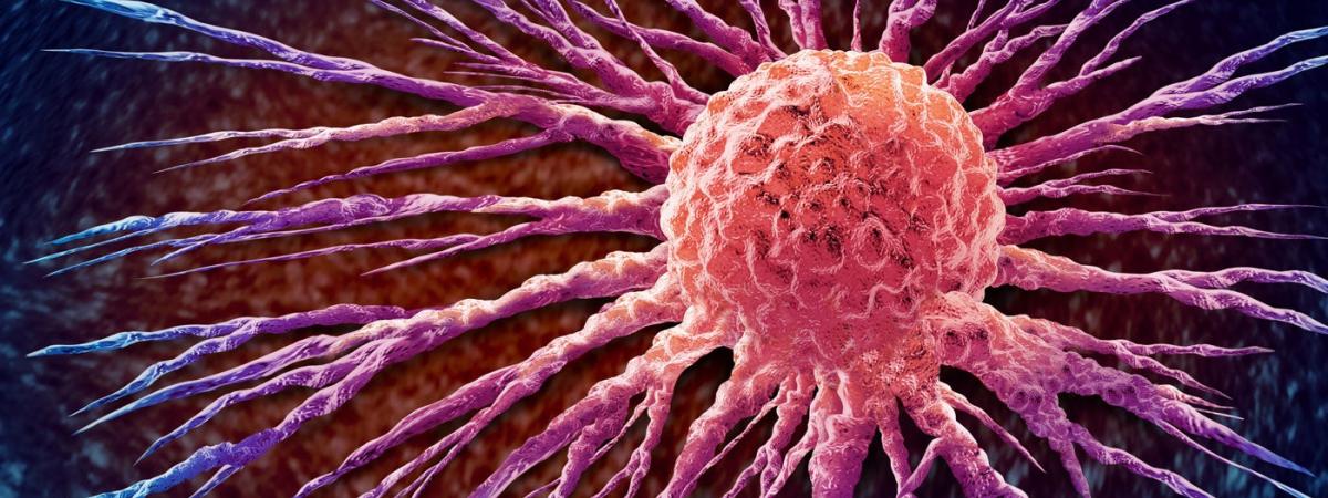 breast-cancer-feat