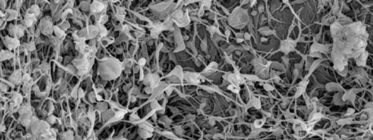 clot-stabilizing-nanotechnology.jpg