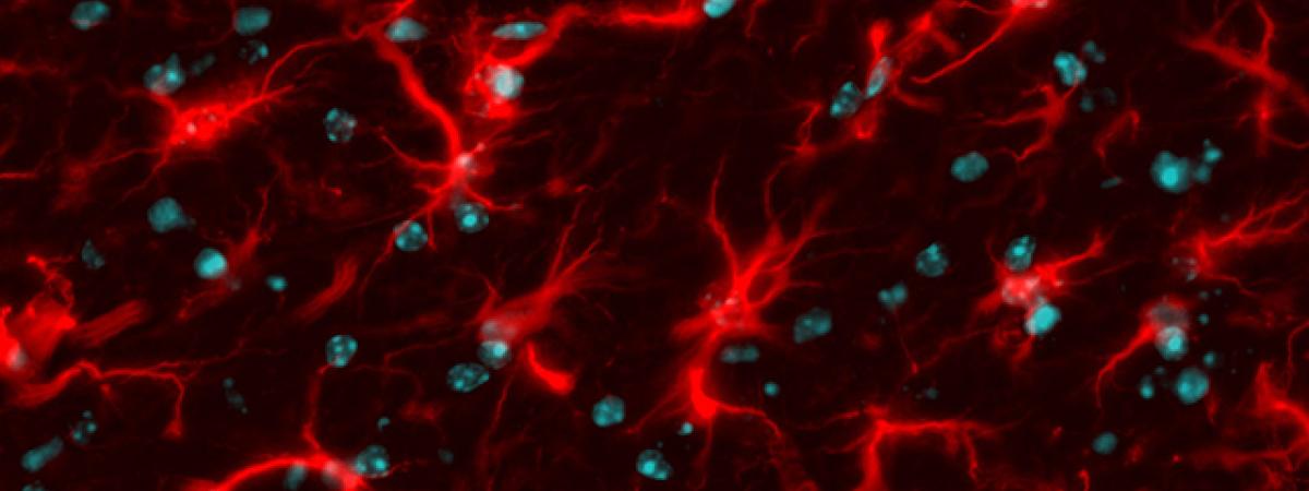 astrocytes.jpeg