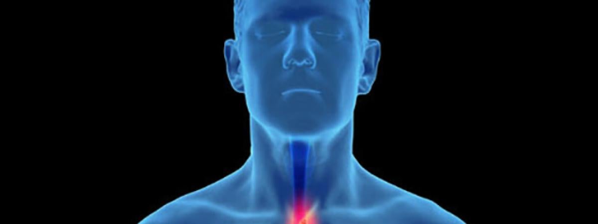 esophagus169.jpg