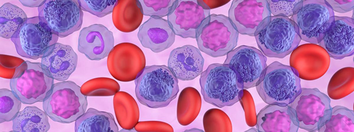 leukemia%20blood%20cells%20stock.jpg