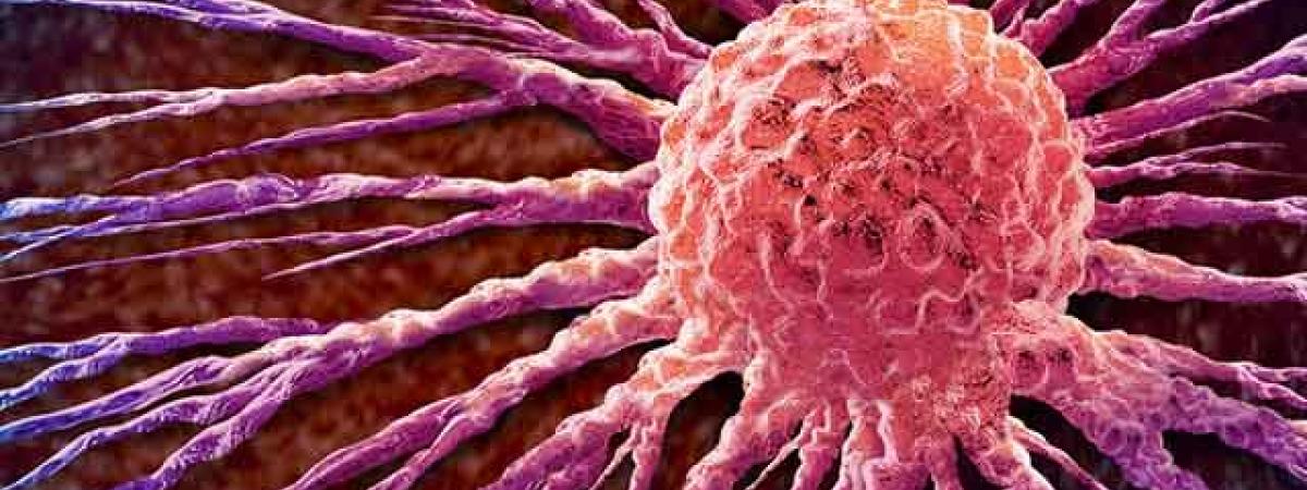 stockbreastcancer.jpg