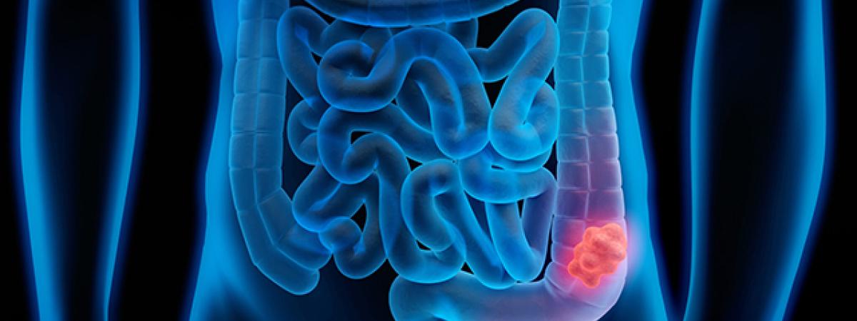 stockgettycolon.jpg