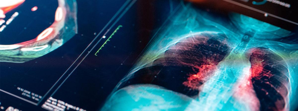 lung-imaging