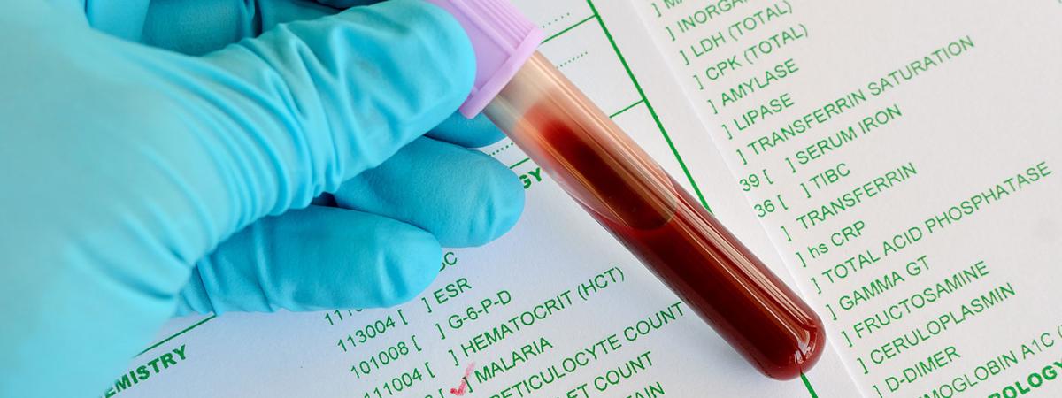 malaria-testing-feat