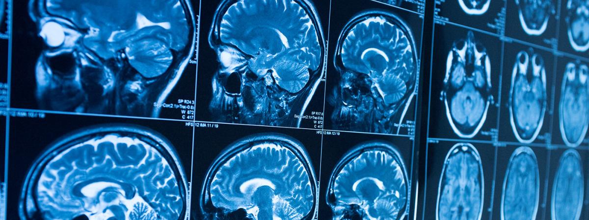 mri-scan-feat