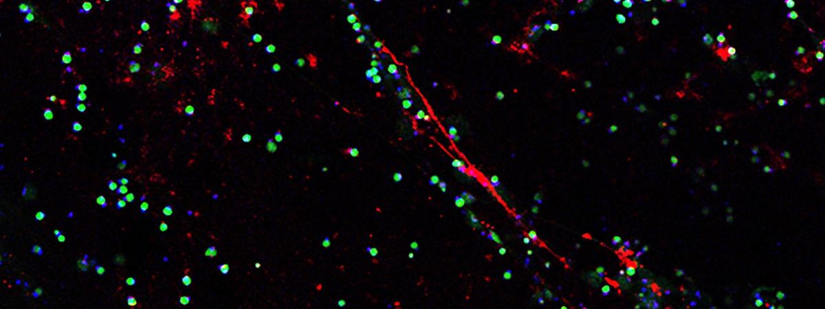 nanoparticles-feat
