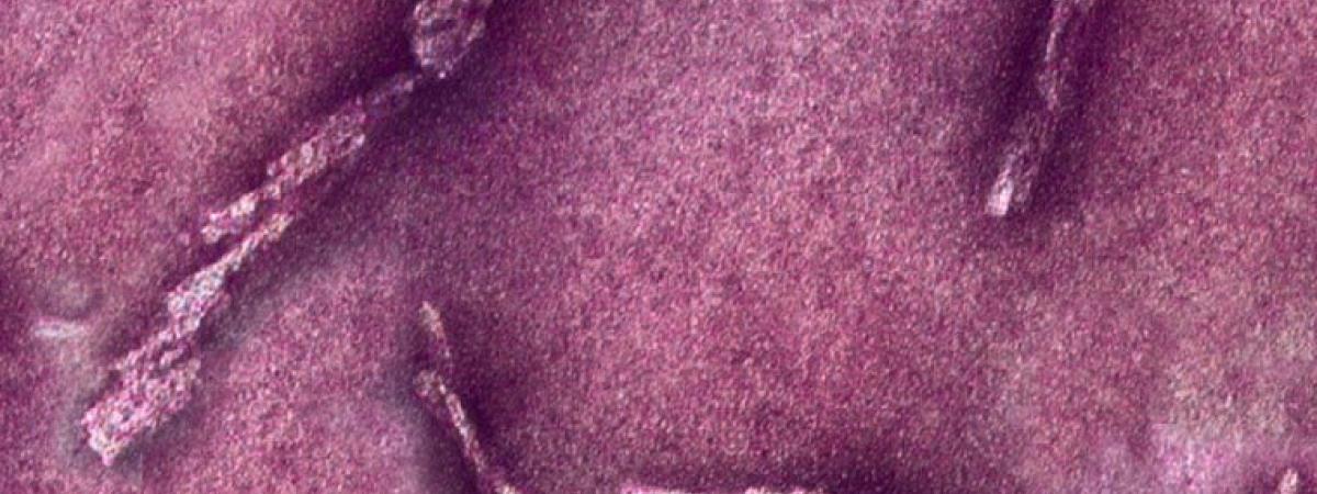 prions-feat