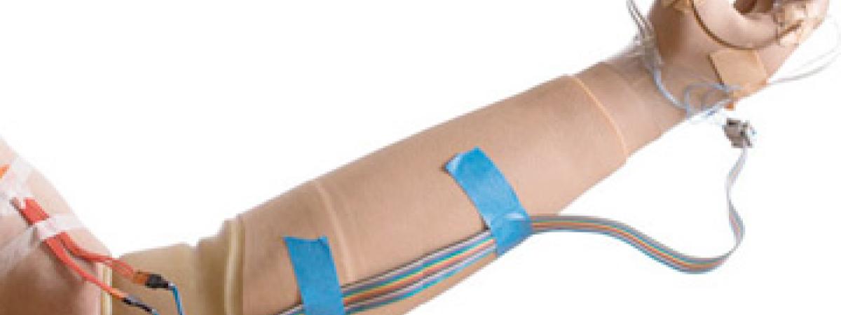 prosthetic-arm