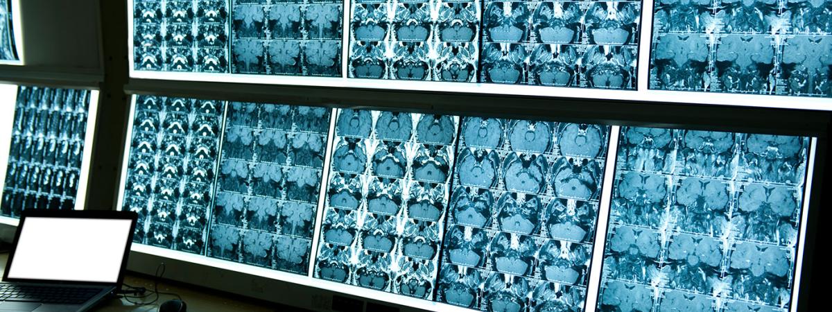 scans