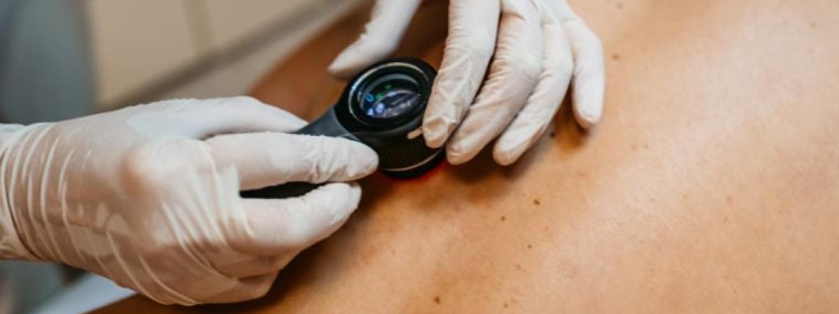 skin-examination