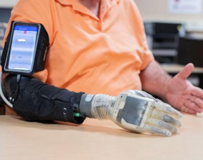 Photo showing a man using an advanced prosthesis