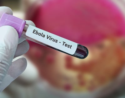 Unidentified hands hold an Ebola virus test sample 