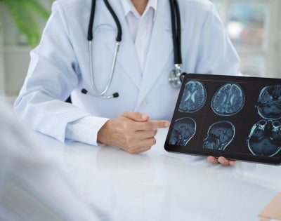 Physician going over brain scan
