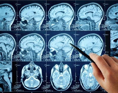Photo of brain scans for medical research.