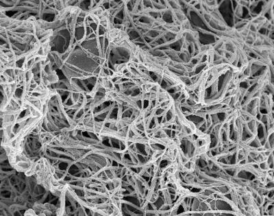 Fibrin_highres